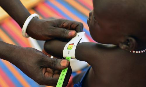 Un travailleur de santé mesure le bras d’un petit garçon pour évaluer son état nutritionnel à Juba, au Soudan du Sud. Photo UNICEF/Christine Nesbitt