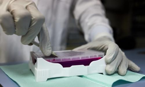 COVID-19 cases rose by 19% to over 278 000 in the week ending on 1 August.