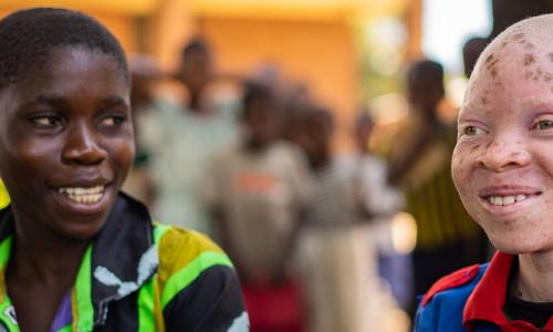 Chinsisi Jafali, a 14-year-old with albinism in Malawi