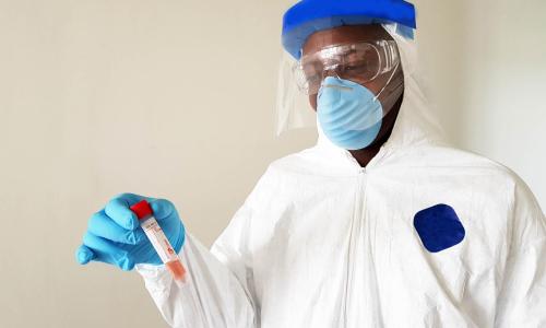 Scientist testing vial