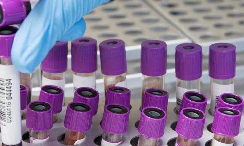 Testing is being conducted to find individuals affected by COVID-19