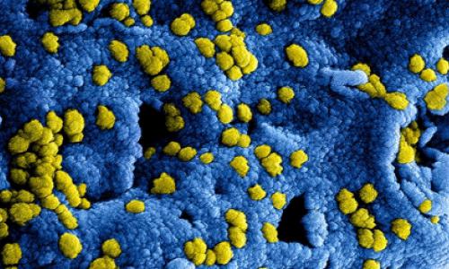 Countries are getting ready to manage the spread of the virus ...